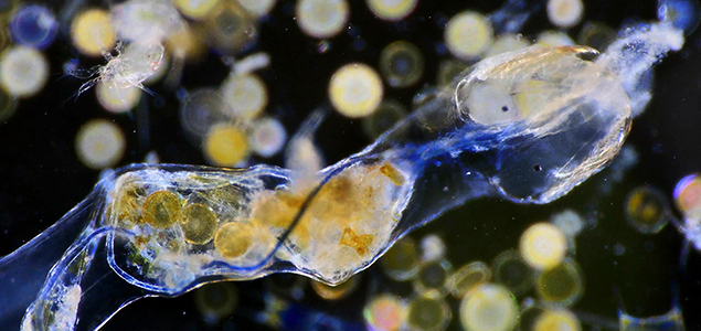 New Study Reveals Global Water Supply Contaminated by Microplastic Fibers